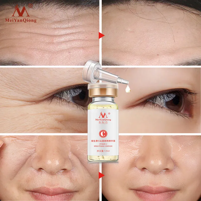 Vitamin C Whitening Freckle Serum Remove Melasma Dark Spots Cream Moisturizing Brighten Firming Face Essence Skin Care Cosmetics