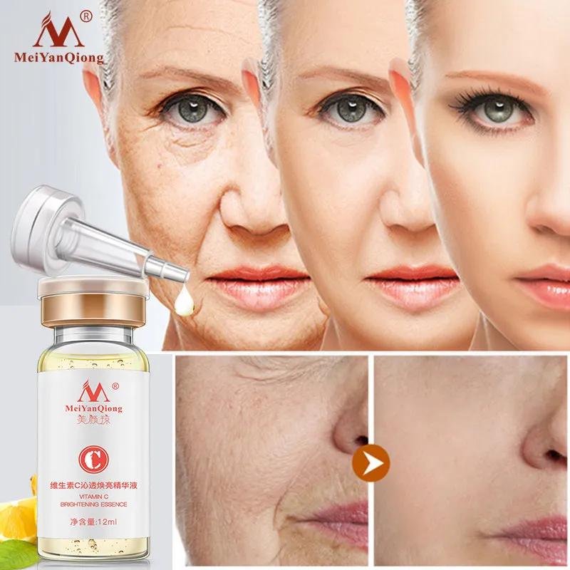 Vitamin C Whitening Freckle Serum Remove Melasma Dark Spots Cream Moisturizing Brighten Firming Face Essence Skin Care Cosmetics