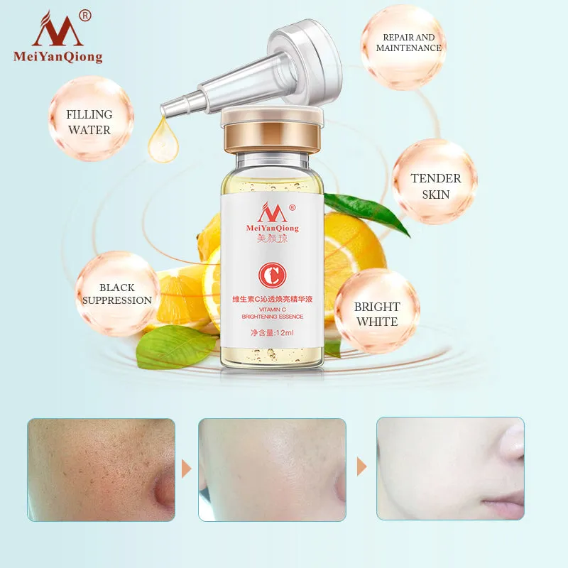 Vitamin C Whitening Freckle Serum Remove Melasma Dark Spots Cream Moisturizing Brighten Firming Face Essence Skin Care Cosmetics